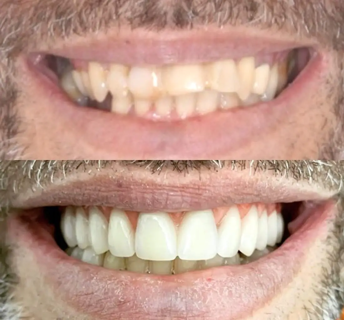 Odontologia com Excelência - Instituto Ramos Costa
